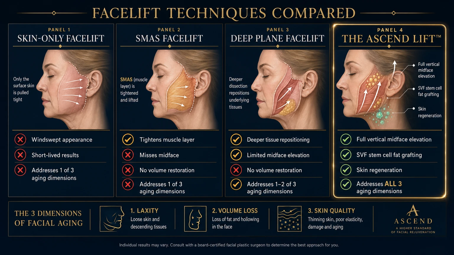 Facelift techniques compared: Skin-only facelift, SMAS facelift, Deep plane facelift, and The Ascend Lift — showing anatomical differences and outcomes — Dr. Shim Ching Honolulu Hawaii